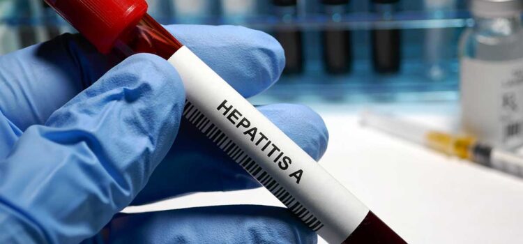 Aumentan casos de Hepatitis “A”